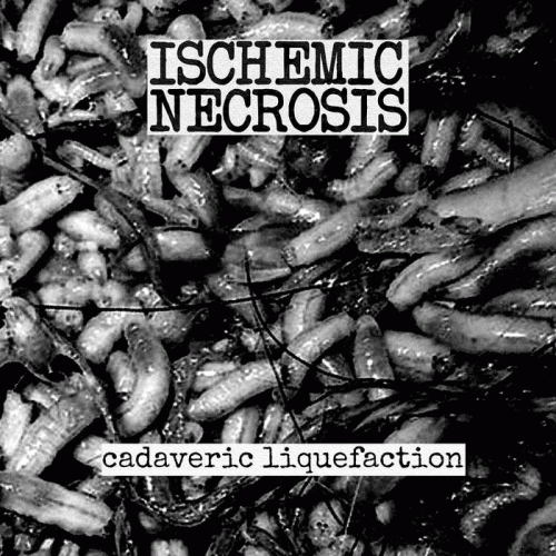 Ischemic Necrosis : Cadaveric Liquefaction